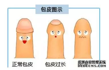包皮长